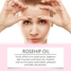 rosehip facial oil