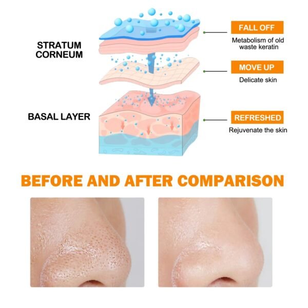 niacinamide exfoliating gel